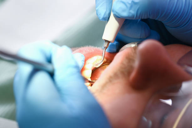 Best Pediatric Emergency Dentist in Huntington, TX