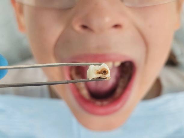 Best Emergency Dental Services for Seniors in Huntington, TX